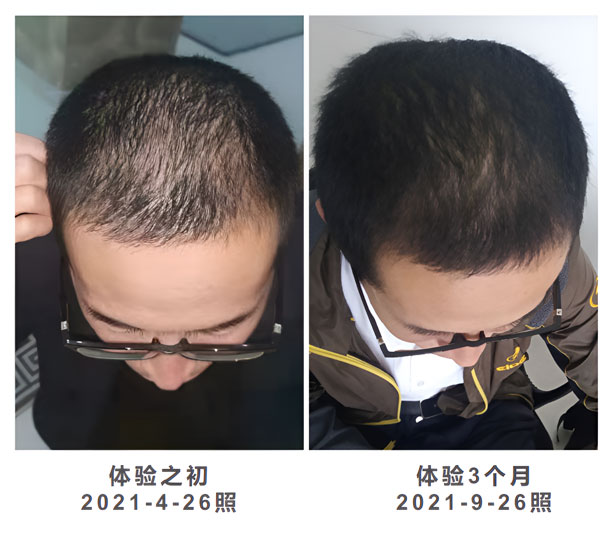 河北体验官3个月增发效果肉眼可见
